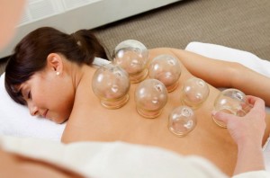 Cupping Therapy